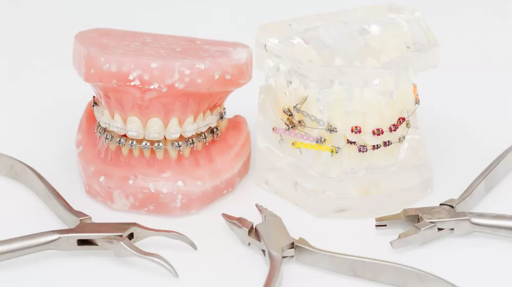 Orthodontic Dental Supplies